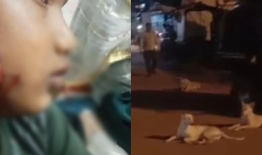कुत्तों के झुंड ने मासूम पर किया हमला:ट्यूशन से घर लौट रहा था सात साल का बच्चा, मीट मार्केट में रहता है डॉग्स का जमावड़ा
