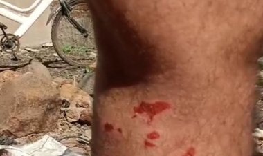 सिवनी के केवलारी में पालतू कुत्तों ने युवक को कटा:घायल ने मालिकों के खिलाफ थाने में शिकायत दर्ज कराई